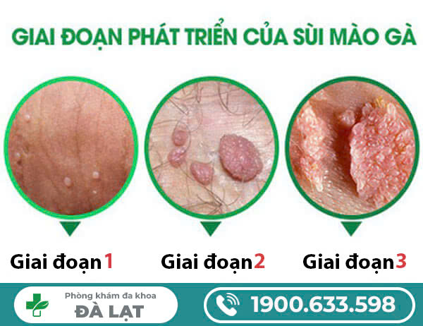 Hình ảnh minh họa
